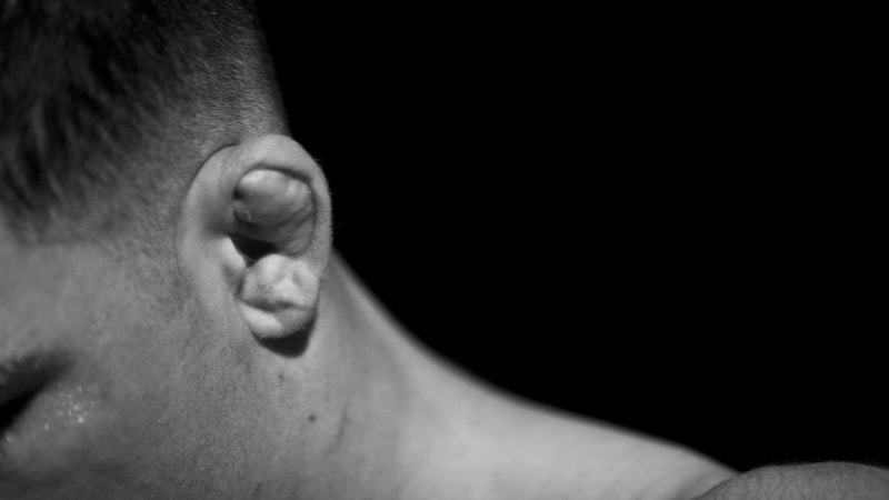 Nový riskantní TikTok trend: „Květákové uši“ lákají na drsnou vizáž, hrozí trvalé následky